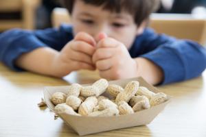Food and environmental allergies